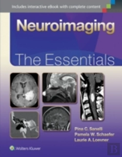 Bertrand.pt - Neuroimaging The Essentials