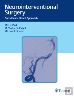 Bertrand.pt - Neurointerventional Surgery