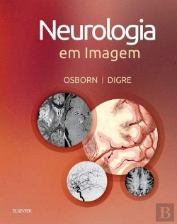 Bertrand.pt - Neurologia em Imagem