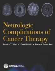 Neurologic Complications Of Cancer Therapy