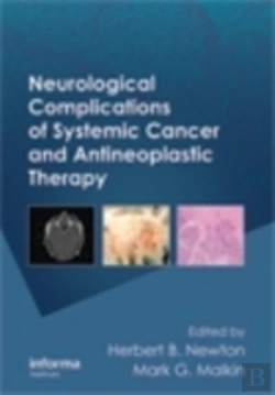 Bertrand.pt - Neurological Complications Of Systemic Cancer And Antineoplastic Therapy