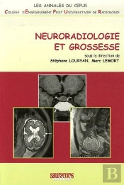 Neuroradiologie Et Grossesse