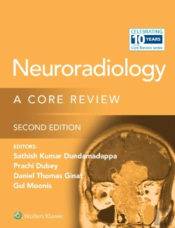 Bertrand.pt - Neuroradiology