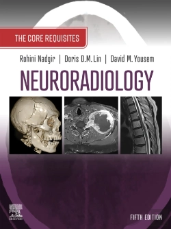 Bertrand.pt - Neuroradiology: The Requisites E-Book