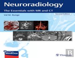 Neuroradiology