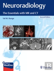 Neuroradiology