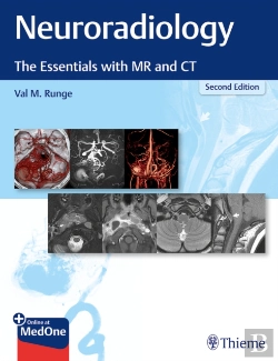 Bertrand.pt - Neuroradiology