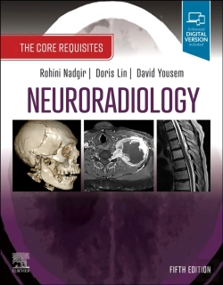 Bertrand.pt - Neuroradiology