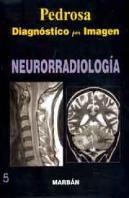 Neurorradiologia