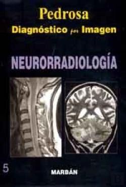 Bertrand.pt - Neurorradiologia