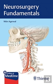 Neurosurgery Fundamentals