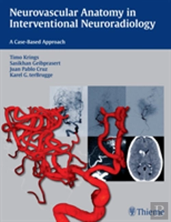 Bertrand.pt - Neurovascular Anatomy In Interventional Neuroradiology