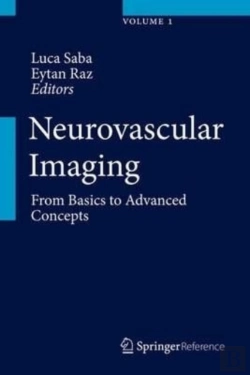 Bertrand.pt - Neurovascular Imaging
