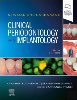 Bertrand.pt - Newman And Carranza'S Clinical Periodontology And Implantology E-Book