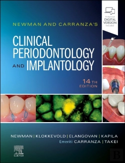 Bertrand.pt - Newman And Carranza'S Clinical Periodontology And Implantology