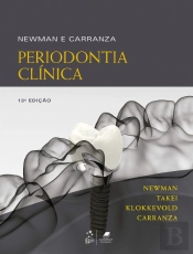 Newman e Carranza - Periodontia Clínica