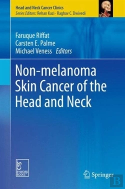 Bertrand.pt - Non-Melanoma Skin Cancer Of The Head And Neck