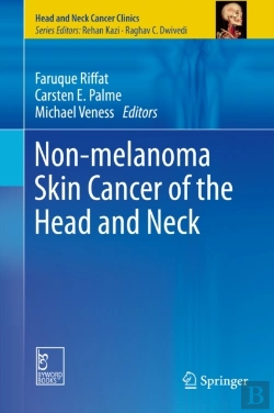 Bertrand.pt - Non-Melanoma Skin Cancer Of The Head And Neck