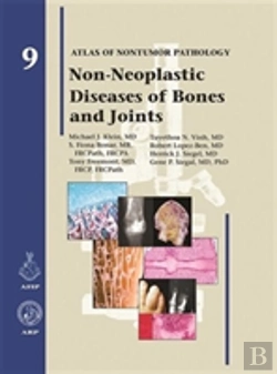 Bertrand.pt - Non-Neoplastic Diseases Of Bones And Joints