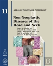Non-Neoplastic Diseases Of The Head And Neck