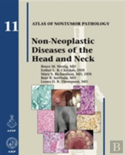 Bertrand.pt - Non-Neoplastic Diseases Of The Head And Neck