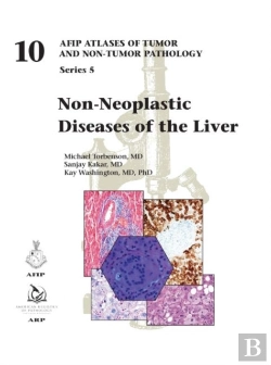 Bertrand.pt - Non-Neoplastic Diseases Of The Liver