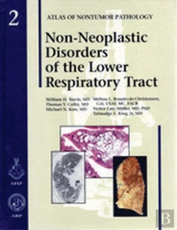Bertrand.pt - Non-Neoplastic Disorders Of The Lower Respiratory Tract