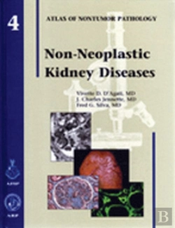 Bertrand.pt - Non-Neoplastic Kidney Diseases