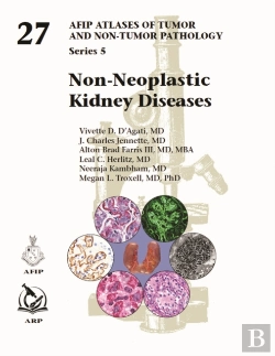 Bertrand.pt - Non-Neoplastic Kidney Diseases