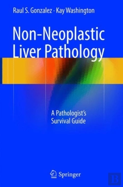 Bertrand.pt - Non-Neoplastic Liver Pathology