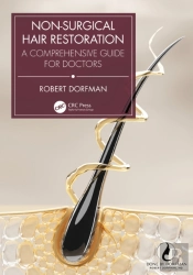 Non-Surgical Hair Restoration