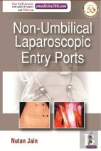 Non-Umbilical Laparoscopic Entry Ports