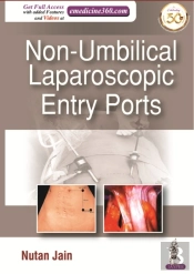 Non-Umbilical Laparoscopic Entry Ports