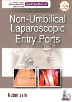 Bertrand.pt - Non-Umbilical Laparoscopic Entry Ports