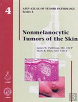 Bertrand.pt - Nonmelanocytic Tumors Of The Skin