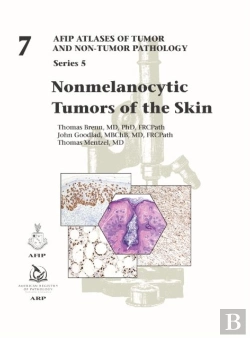 Bertrand.pt - Nonmelanocytic Tumors Of The Skin