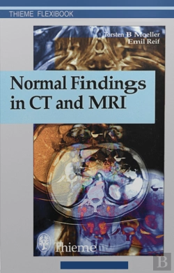Bertrand.pt - Normal Findings In Ct And Mri