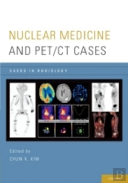 Bertrand.pt - Nuclear Medicine And Pet/Ct Cases