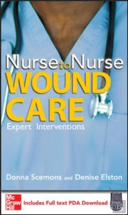 Bertrand.pt - Nurse To Nurse Wound Care