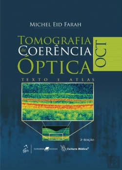 Bertrand.pt - OCT - Tomografia de Coerência Óptica