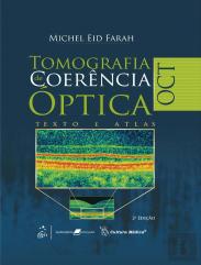 OCT - Tomografia de Coerência Óptica
