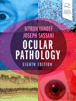 Bertrand.pt - Ocular Pathology