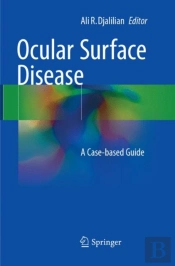 Ocular Surface Disease