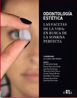 Bertrand.pt - Odontologia Estetica Las Facetas De La Vida: En Busca De La