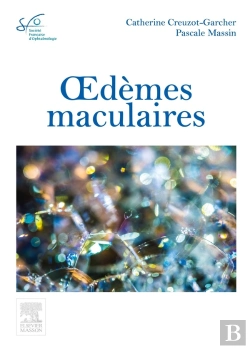 Bertrand.pt - Oedèmes Maculaires