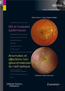 Bertrand.pt - Oeil Et Maladies Systémiques ; Anomalies Et Affections Non Glaucomateuses Du Nerf Optique