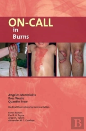 On-Call In Burns