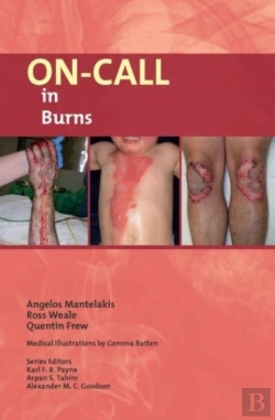 Bertrand.pt - On-Call In Burns