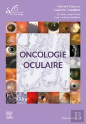 Oncologie Oculaire
