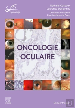 Bertrand.pt - Oncologie Oculaire